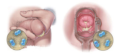 Bách khoa bệnh lây truyền qua đường tình dục - Ảnh 3.