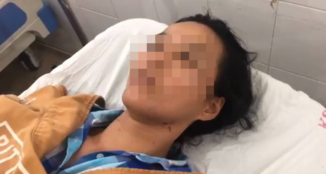 Vụ chồng đánh vợ, dìm xuống nước trước mặt con: Người vợ thấy may mắn vì mình còn sống - Ảnh 3. Vụ chồng đánh vợ, dìm xuống nước trước mặt con: Người vợ thấy may mắn vì mình còn sống - Ảnh 3.