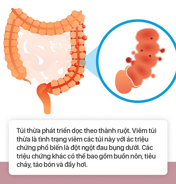 Tình trạng bụng đầy hơi có thể là dấu hiệu cảnh báo 6 bệnh nguy hiểm mà nhiều người không biết - Ảnh 4.