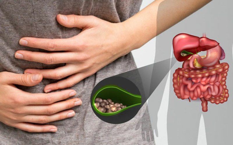 Xơ gan vì sỏi mật, bệnh nhân không ngờ thói quen này là thủ phạm gây bệnh - Ảnh 1. Xơ gan vì sỏi mật, bệnh nhân không ngờ thói quen này là thủ phạm gây bệnh - Ảnh 1.