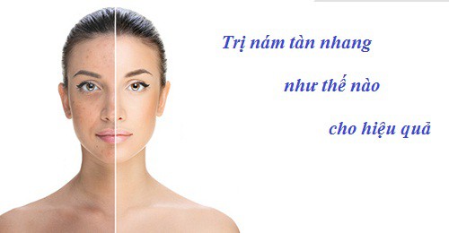 Trị nám –“Tuyệt chiêu” ít người biết tới - Ảnh 1.