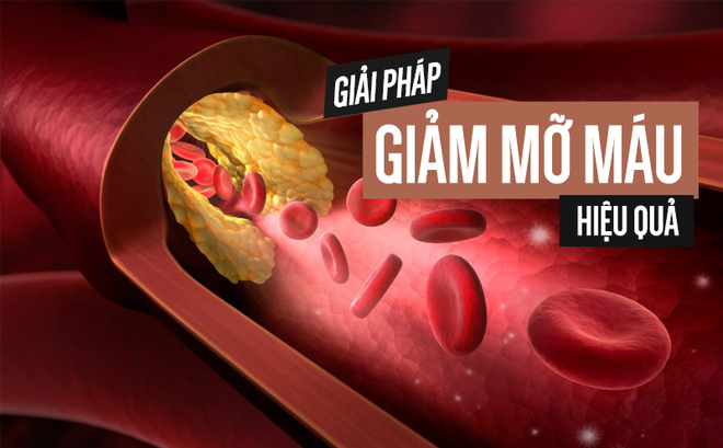 Những người có nguy cơ bị máu nhiễm mỡ cao, nếu có dấu hiệu này bạn cần cảnh giác - Ảnh 2. Những người có nguy cơ bị máu nhiễm mỡ cao, nếu có dấu hiệu này bạn cần cảnh giác - Ảnh 2.