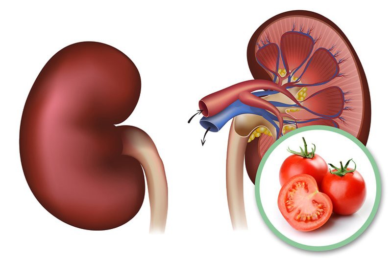 9 tác dụng phụ khi ăn quá nhiều cà chua, điều số 8 nguy hiểm nhất có thể mất mạng - Ảnh 5. 9 tác dụng phụ khi ăn quá nhiều cà chua, điều số 8 nguy hiểm nhất có thể mất mạng - Ảnh 5.