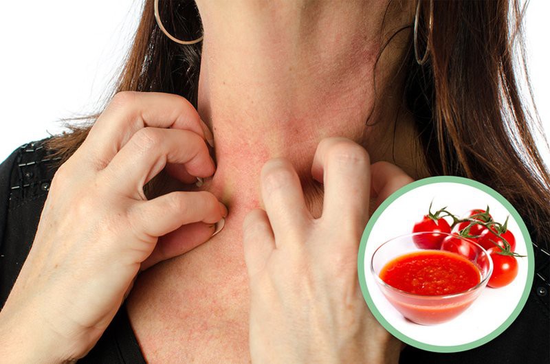 9 tác dụng phụ khi ăn quá nhiều cà chua, điều số 8 nguy hiểm nhất có thể mất mạng - Ảnh 6. 9 tác dụng phụ khi ăn quá nhiều cà chua, điều số 8 nguy hiểm nhất có thể mất mạng - Ảnh 6.