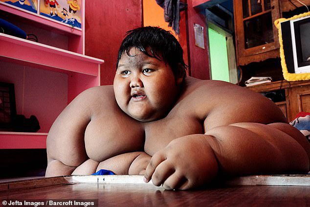 Cậu bé nặng nhất thế giới với gần 200kg sau 4 năm phẫu thuật thu nhỏ dạ dày giờ lột xác không ai nhận ra - Ảnh 2.