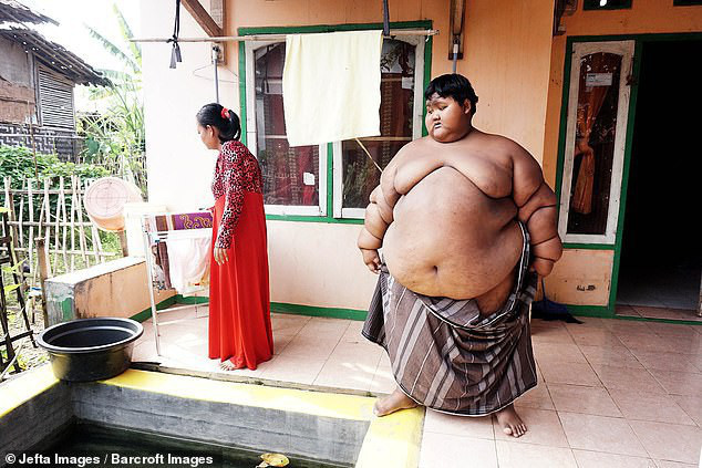 Cậu bé nặng nhất thế giới với gần 200kg sau 4 năm phẫu thuật thu nhỏ dạ dày giờ lột xác không ai nhận ra - Ảnh 5.
