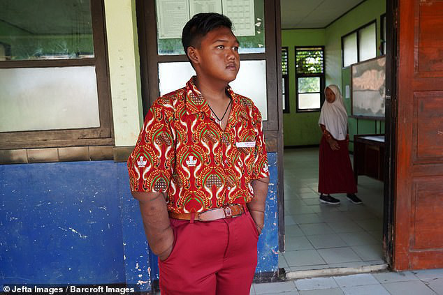 Cậu bé nặng nhất thế giới với gần 200kg sau 4 năm phẫu thuật thu nhỏ dạ dày giờ lột xác không ai nhận ra - Ảnh 8.
