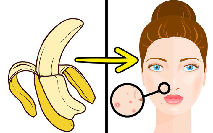 Ăn chuối xong mọi người thường vứt ngay vỏ chuối vào thùng rác mà không hay biết nó còn có những công dụng tuyệt vời khác - Ảnh 2. Ăn chuối xong mọi người thường vứt ngay vỏ chuối vào thùng rác mà không hay biết nó còn có những công dụng tuyệt vời khác - Ảnh 2.