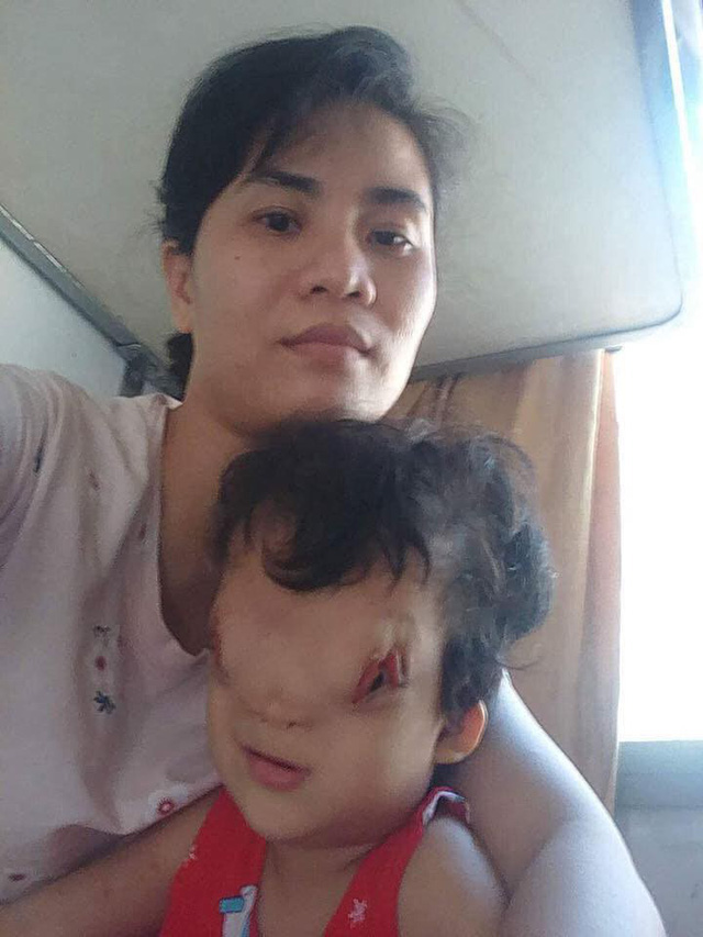 Mẹ của cô bé có khuôn mặt biến dạng ở Quảng Bình gửi con để đi giúp người dân chống lũ - Ảnh 4.