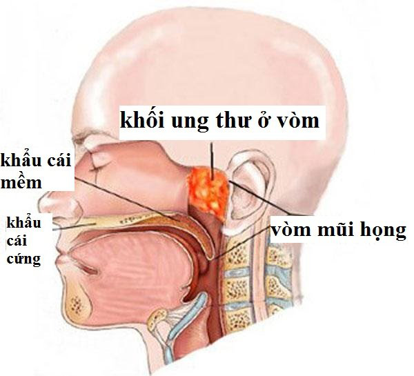 Đây là món cá nhiều người ưa thích được WHO xếp vào nhóm gây ung thư số 1, hãy dừng ăn ngay nếu không muốn mắc ung thư - Ảnh 4.