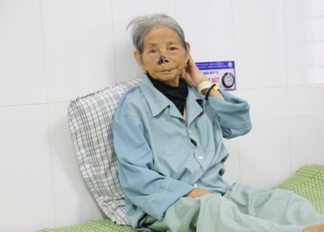 Cụ bà cao tuổi nhất Việt Nam ở Phú Thọ bị nhồi máu cơ tim may mắn được cứu sống - Ảnh 2.