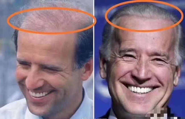 76 tuổi vẫn phong độ lịch lãm, ông Joe Biden để lộ bằng chứng nhiều lần phẫu thuật níu kéo tuổi xuân từ cấy tóc, căng da đến cắt mí - Ảnh 4. 76 tuổi vẫn phong độ lịch lãm, ông Joe Biden để lộ bằng chứng nhiều lần phẫu thuật níu kéo tuổi xuân từ cấy tóc, căng da đến cắt mí - Ảnh 4.