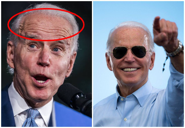 76 tuổi vẫn phong độ lịch lãm, ông Joe Biden để lộ bằng chứng nhiều lần phẫu thuật níu kéo tuổi xuân từ cấy tóc, căng da đến cắt mí - Ảnh 5. 76 tuổi vẫn phong độ lịch lãm, ông Joe Biden để lộ bằng chứng nhiều lần phẫu thuật níu kéo tuổi xuân từ cấy tóc, căng da đến cắt mí - Ảnh 5.