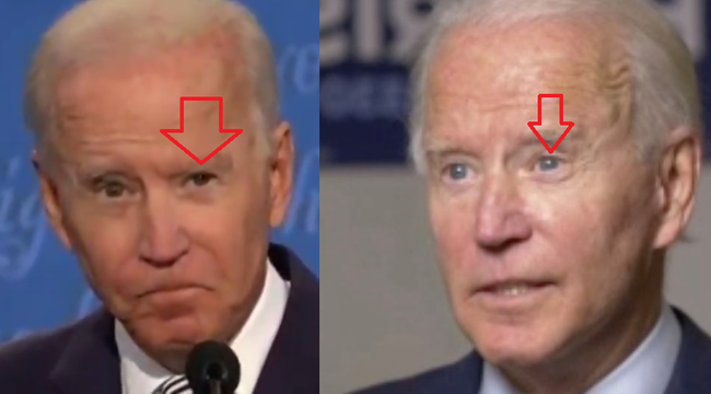 76 tuổi vẫn phong độ lịch lãm, ông Joe Biden để lộ bằng chứng nhiều lần phẫu thuật níu kéo tuổi xuân từ cấy tóc, căng da đến cắt mí - Ảnh 6. 76 tuổi vẫn phong độ lịch lãm, ông Joe Biden để lộ bằng chứng nhiều lần phẫu thuật níu kéo tuổi xuân từ cấy tóc, căng da đến cắt mí - Ảnh 6.