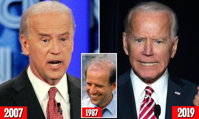 76 tuổi vẫn phong độ lịch lãm, ông Joe Biden để lộ bằng chứng nhiều lần phẫu thuật níu kéo tuổi xuân từ cấy tóc, căng da đến cắt mí - Ảnh 8. 76 tuổi vẫn phong độ lịch lãm, ông Joe Biden để lộ bằng chứng nhiều lần phẫu thuật níu kéo tuổi xuân từ cấy tóc, căng da đến cắt mí - Ảnh 8.