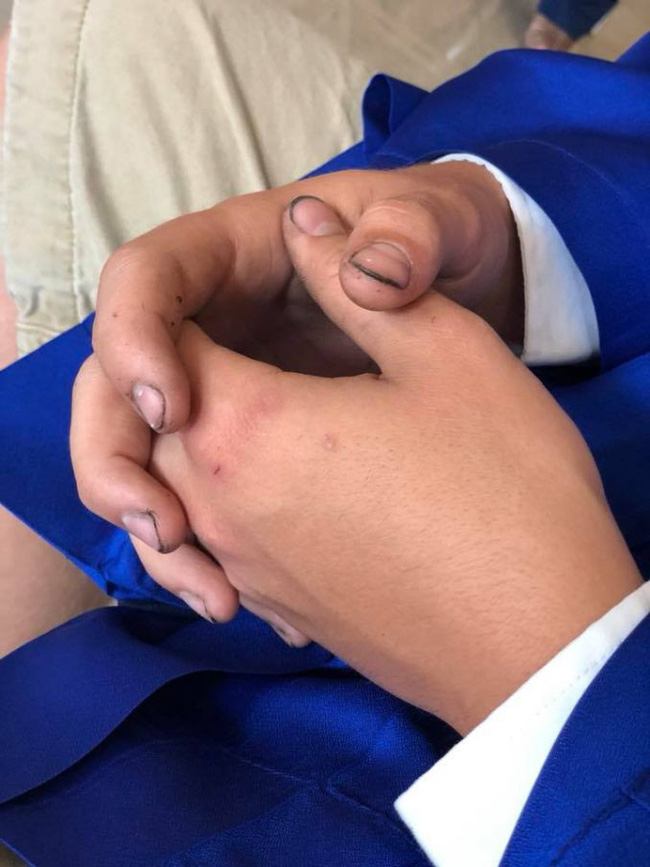 Đang chờ chụp ảnh kỷ yếu cho con trai, người mẹ nhìn thấy đôi bàn tay của đứa trẻ rồi bật khóc tại chỗ - Ảnh 3. Đang chờ chụp ảnh kỷ yếu cho con trai, người mẹ nhìn thấy đôi bàn tay của đứa trẻ rồi bật khóc tại chỗ - Ảnh 3.