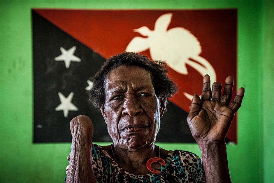 Số phận bi thảm của người bị kết tội phù thủy ở Papua New Guinea - Ảnh 4. Số phận bi thảm của người bị kết tội phù thủy ở Papua New Guinea - Ảnh 4.