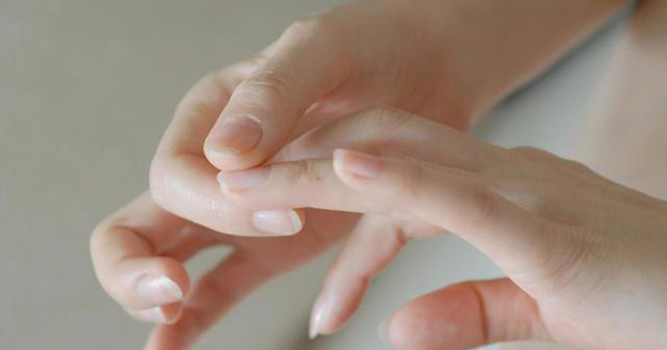 Quan sát đôi tay, nếu thấy có 3 tín hiệu xấu thì nên chú ý sức khỏe vì nguy cơ mắc bệnh về gan rất cao - Ảnh 3.