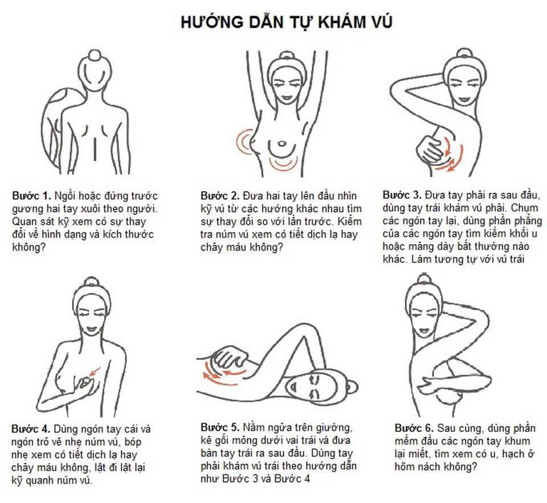 Cách sờ, nắn ngực để phát hiện bất thường ở vú, dự phòng nguy cơ mắc ung thư vú - Ảnh 3. Cách sờ, nắn ngực để phát hiện bất thường ở vú, dự phòng nguy cơ mắc ung thư vú - Ảnh 3.
