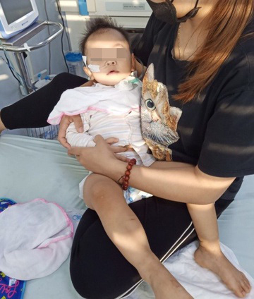 Bé gái 19 tháng tuổi liệt chi vì bệnh chân tay miệng - Ảnh 1.