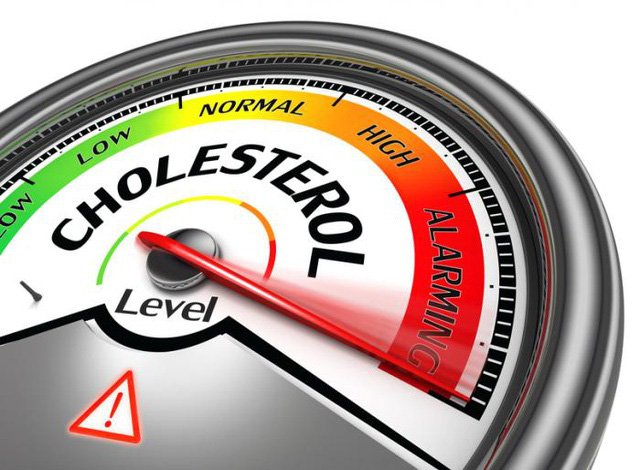 Mức cholesterol nên là bao nhiêu với mỗi độ tuổi? - Ảnh 1.