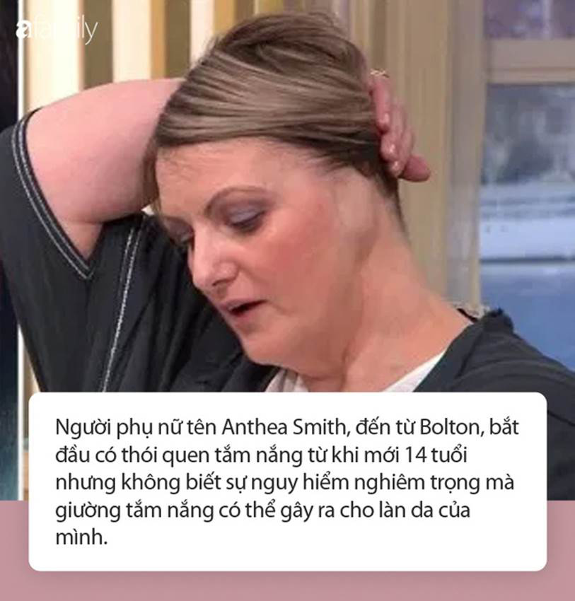 Nằm giường tắm nắng, một phụ nữ phải cắt cụt tai do ung thư da - Ảnh 1. Nằm giường tắm nắng, một phụ nữ phải cắt cụt tai do ung thư da - Ảnh 1.