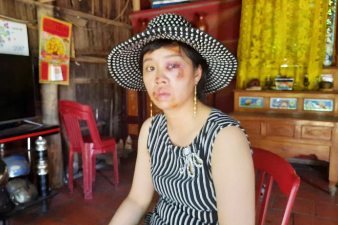 Truy bắt hai tên cướp liên tiếp giật túi xách trong đêm - Ảnh 1. Truy bắt hai tên cướp liên tiếp giật túi xách trong đêm - Ảnh 1.