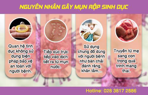 Mụn rộp sinh dục - Ảnh 1.