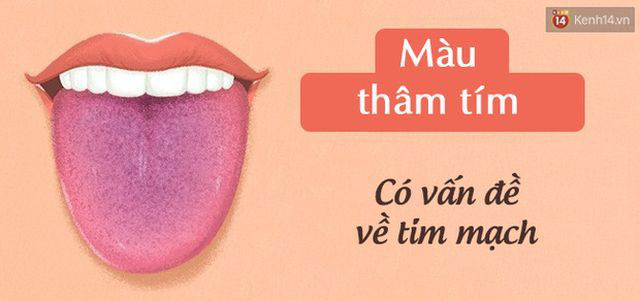 3 đốm đen xuất hiện trên cơ thể cảnh báo bệnh nhồi máu cơ tim - Ảnh 3.