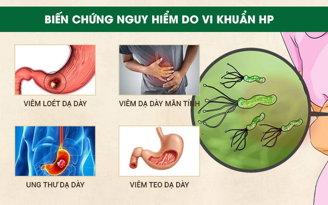 Phòng bệnh ung thư dạ dày: Khuyến cáo từ chuyên gia Bệnh viện K - Ảnh 2. Phòng bệnh ung thư dạ dày: Khuyến cáo từ chuyên gia Bệnh viện K - Ảnh 2.