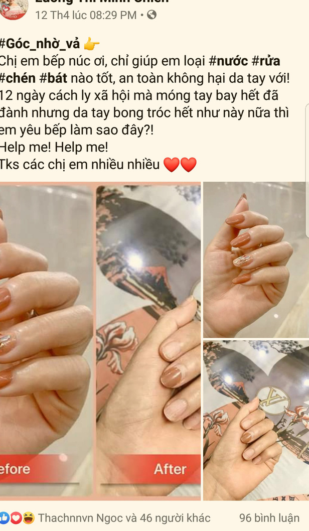 “Phát hoảng” vì tay khô bong tróc do nấu ăn quần quật trong những ngày giãn cách xã hội vì COVID-19 - Ảnh 2.