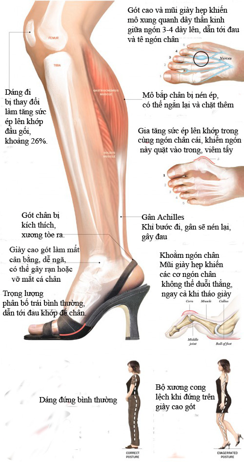 Hoa hậu H’Hen Niê biết chiêu này thì đôi giày cao gót gần 120 triệu đồng không làm chân đau, sưng vù và phải đi dép tổ ong ra đường - Ảnh 3.