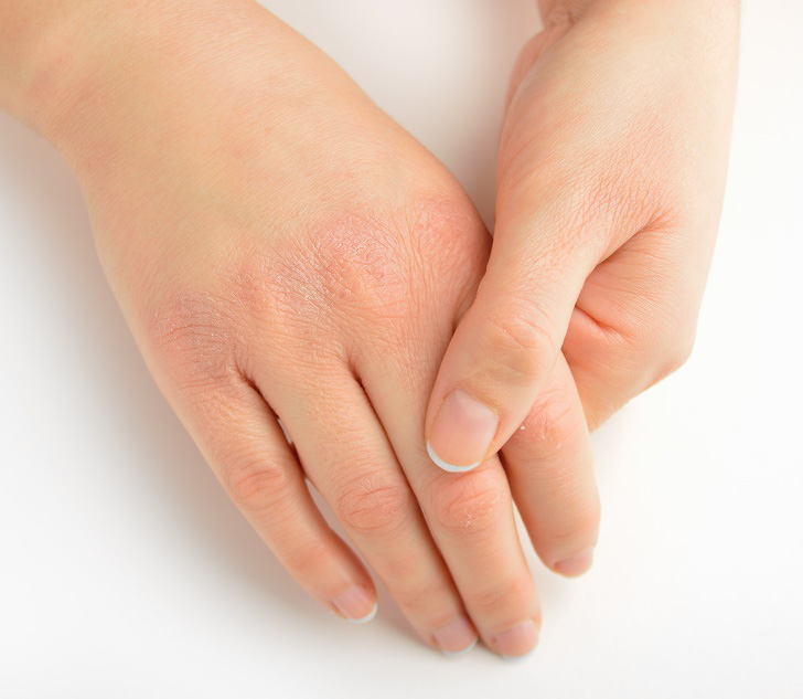 10 dấu hiệu cơ thể bạn đang mang trọng bệnh hoặc sức khỏe tụt dốc - Ảnh 2. 10 dấu hiệu cơ thể bạn đang mang trọng bệnh hoặc sức khỏe tụt dốc - Ảnh 2.