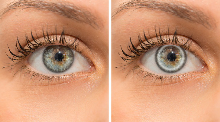 10 dấu hiệu cơ thể bạn đang mang trọng bệnh hoặc sức khỏe tụt dốc - Ảnh 6. 10 dấu hiệu cơ thể bạn đang mang trọng bệnh hoặc sức khỏe tụt dốc - Ảnh 6.