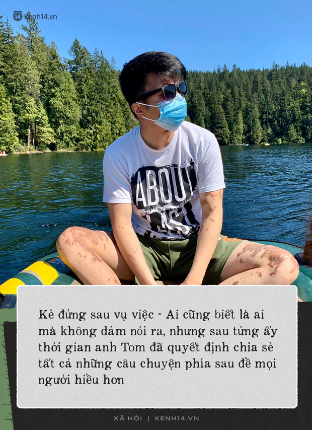 Trải lòng của người vợ Việt kiều Canada bị tạt axit, cắt gân chân: Mỗi lần chồng phải vào phòng phẫu thuật là một lần mình rơi nước mắt - Ảnh 12.