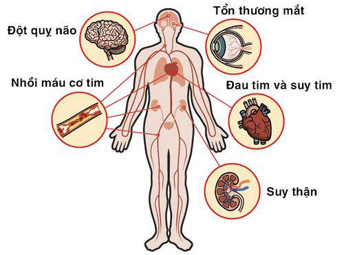 Xu hướng mới giúp hỗ trợ cải thiện tăng huyết áp vô căn nhờ Định Áp Vương - Ảnh 2.