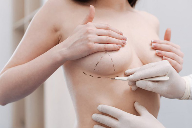 Cô gái trẻ bị lở loét, mưng mủ sau khi thực hiện nâng ngực chảy xệ ở spa chất lượng kém: Bài học đắt giá cho những chị em đang muốn thực hiện! - Ảnh 4. Cô gái trẻ bị lở loét, mưng mủ sau khi thực hiện nâng ngực chảy xệ ở spa chất lượng kém: Bài học đắt giá cho những chị em đang muốn thực hiện! - Ảnh 4.