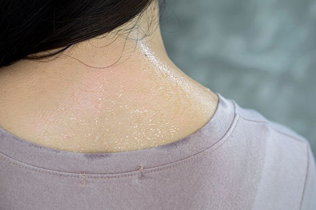 Nếu bạn bị đổ mồ hôi ở những khu vực này thì cơ thể đang gặp vấn đề, một trong số đó là dấu hiệu của đột quỵ - Ảnh 2. Nếu bạn bị đổ mồ hôi ở những khu vực này thì cơ thể đang gặp vấn đề, một trong số đó là dấu hiệu của đột quỵ - Ảnh 2.