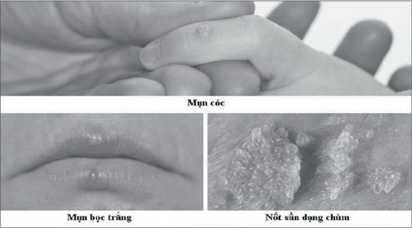  Tình dục bằng miệng, coi chừng lây bệnh - Ảnh 1.