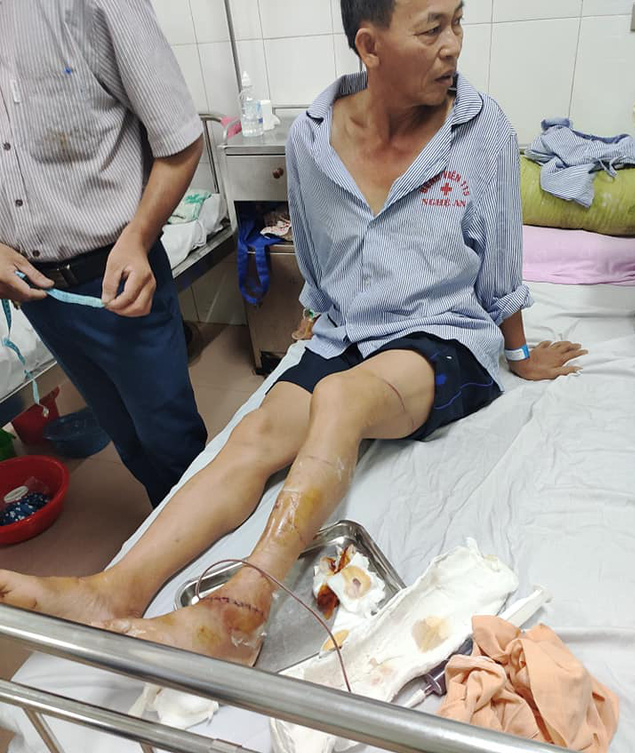 Hà Tĩnh: Bắt khẩn cấp đối tượng dùng dao chém công an viên nhập viện - Ảnh 2.
