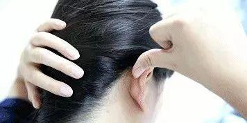 Cơ thể con người có 5 công tắc để mọc tóc, hãy bấm mỗi ngày để ngăn rụng tóc và tạm biệt hói đầu - Ảnh 3.