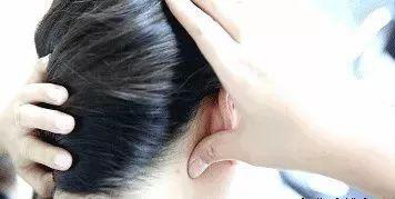 Cơ thể con người có 5 công tắc để mọc tóc, hãy bấm mỗi ngày để ngăn rụng tóc và tạm biệt hói đầu - Ảnh 4.