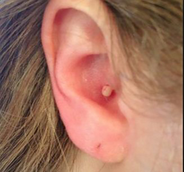 Nếu thấy dấu hiệu này ở tai thì chứng tỏ cơ thể bạn đang gặp rắc rối lớn - Ảnh 3.
