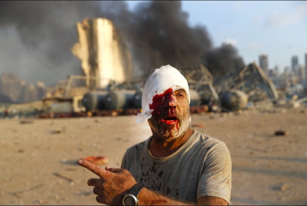 Hình ảnh thảm khốc đẫm máu trong vụ nổ thảm khốc ở Lebanon: Phụ nữ la hét, người lính gục khóc tại chỗ - Ảnh 4.