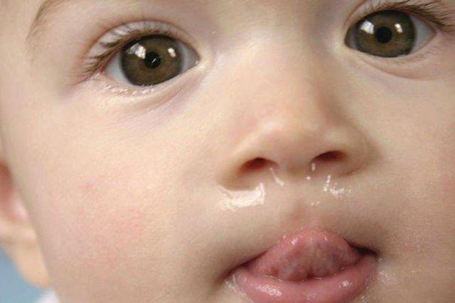 Từ vụ bé 2 tuổi suýt mất mạng vì mẹ rửa mũi bằng nước muối sinh lý, chuyên gia chỉ rõ sai lầm chết người - Ảnh 2.