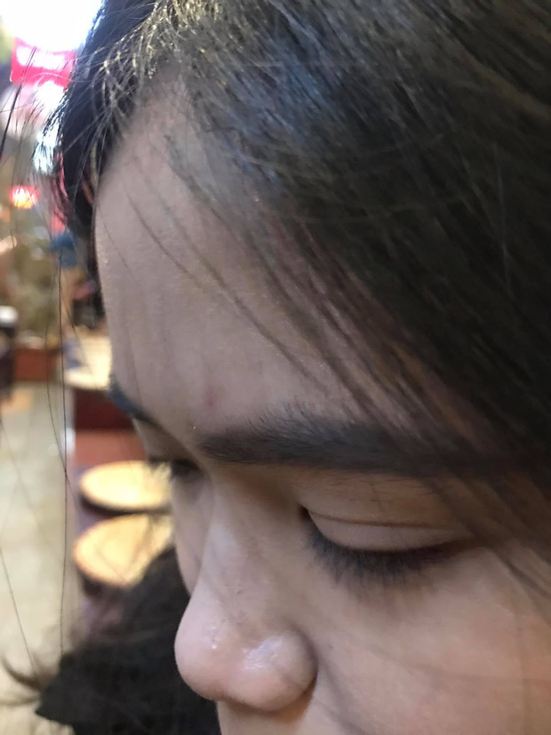 Đi bar trên phố Tạ Hiện, cô gái bất ngờ bị bạn gái của quản lý quán hành hung, ném bát gạt tàn vào đầu - Ảnh 2.