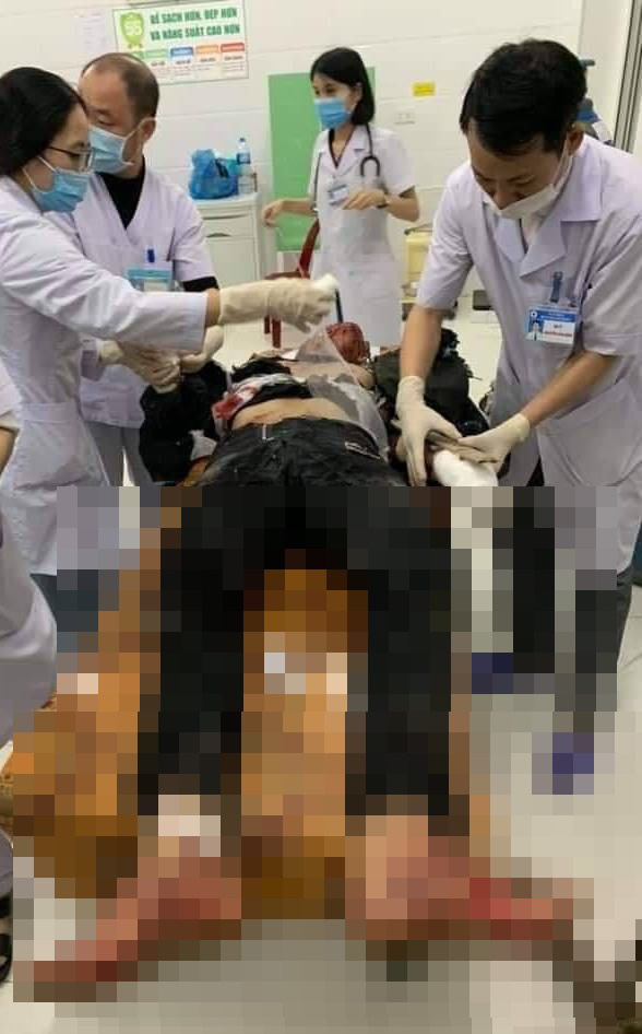 Nghệ An: Một học sinh dập nát bàn tay sau tiếng nổ lớn - Ảnh 1.