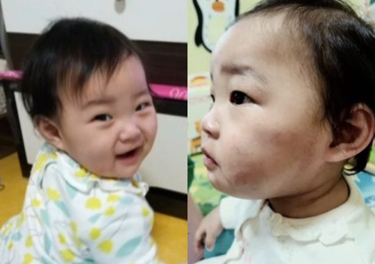 Vụ bé gái 16 tháng tuổi bị bố mẹ nuôi bạo hành đến chết: Cảnh sát Hàn Quốc cúi đầu tạ lỗi vì 3 lần thờ ơ, gián tiếp gây ra cái chết đau thương - Ảnh 3.
