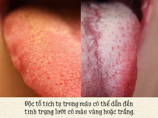 Mắc phải 8 vấn đề dưới đây, nàng cần detox cơ thể càng sớm càng tốt - Ảnh 6.