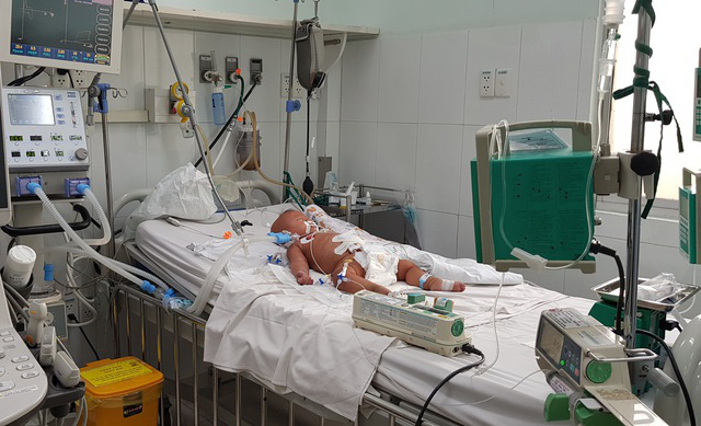 Vết muỗi ch&iacute;ch khiến b&eacute; 9 th&aacute;ng tuổi sốc nặng, nguy kịch - Ảnh 2.